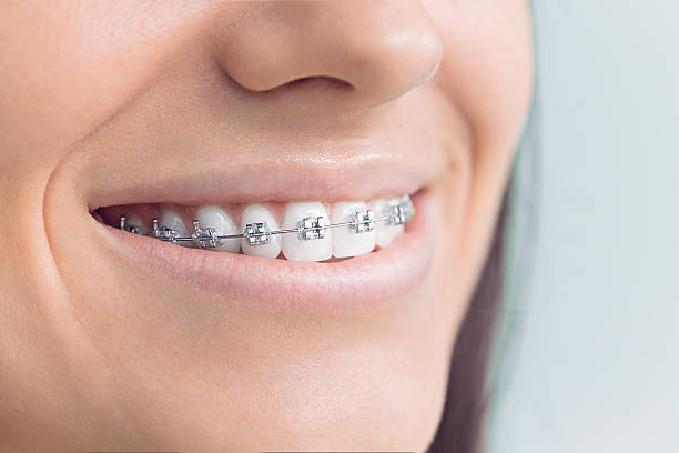 Best Dental Inlays and Onlays  in Rock Hill, MO